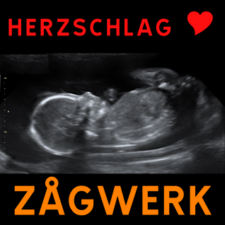 Herzschlag / Zågwerk